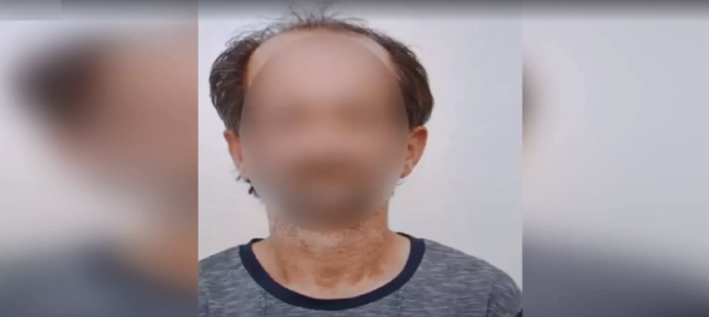 Γυναικοκτονία στη Ζάκυνθο: Στον Εισαγγελέα ο καθ΄ ομολογίαν του δράστης