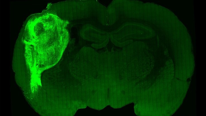 εγκέφαλος επιστήμονες