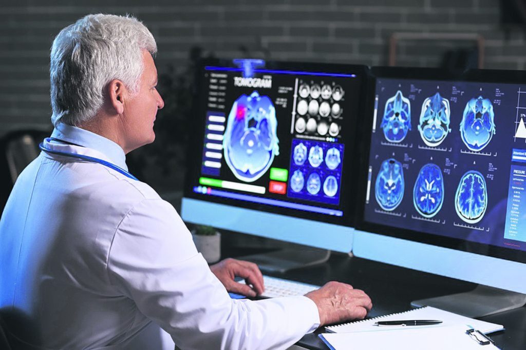 Αλτσχάιμερ