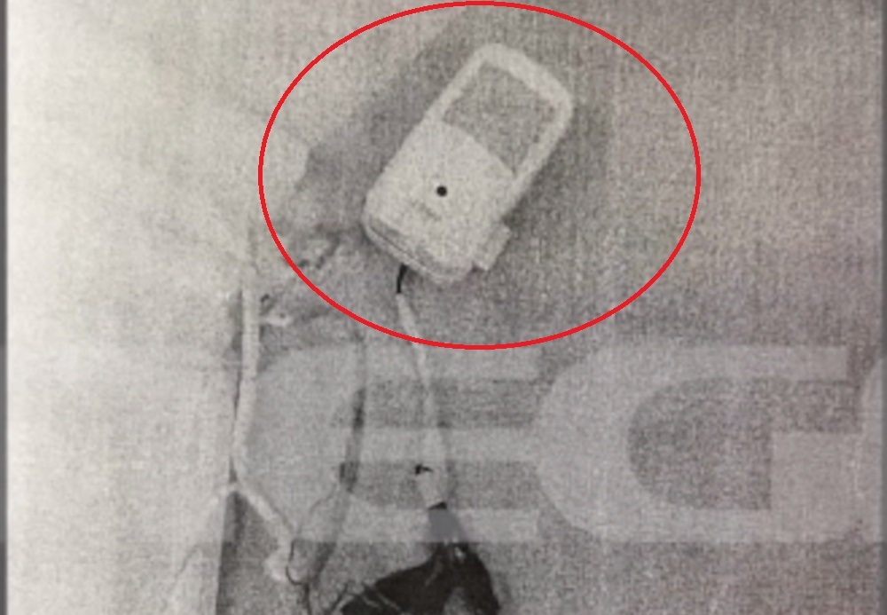 Θεσσαλονίκη: Φοιτήτρια καταγγέλλει παρακολούθησή της μέσω κάμερας σε σπίτι που νοίκιασε