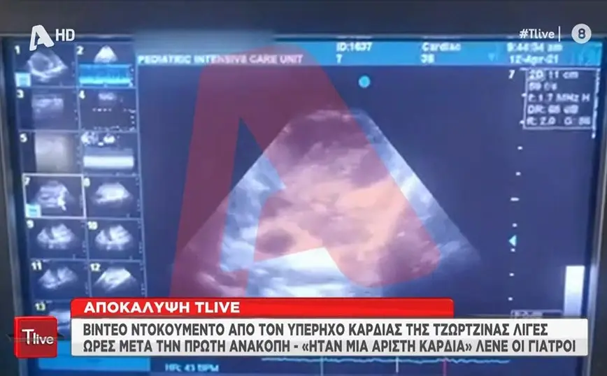 Εσωτερική εικόνα άρθρου
