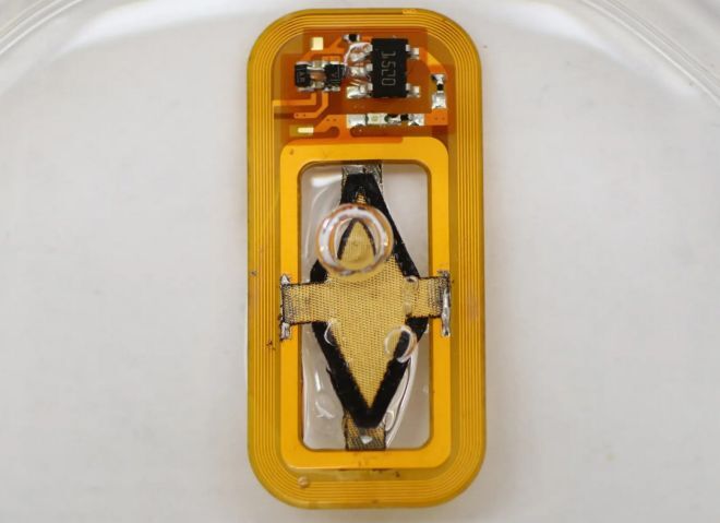 εμφύτευμα διαβήτης