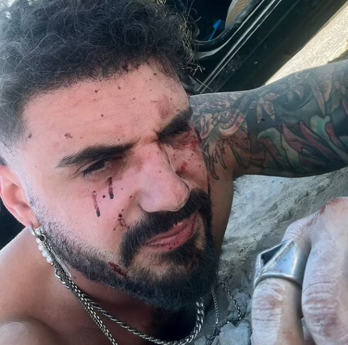 Πόλεμος στο Ισραήλ: Κόβουν την ανάσα οι περιγραφές Αμερικάνου που επέζησε από το μουσικό φεστιβάλ