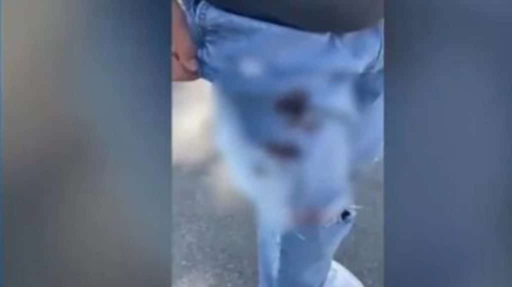Μεσσήνη: «Δεν ξέρουμε πώς να προστατευτούμε» λένε οι γονείς για το μαχαίρωμα 14χρονου από συμμαθητή 
