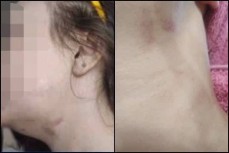 Ο εφιάλτης που βίωσε η 28χρονη – Πήδηξε από τον δεύτερο όροφο για να μην την πνίξει ο σύντροφός της [βίντεο]