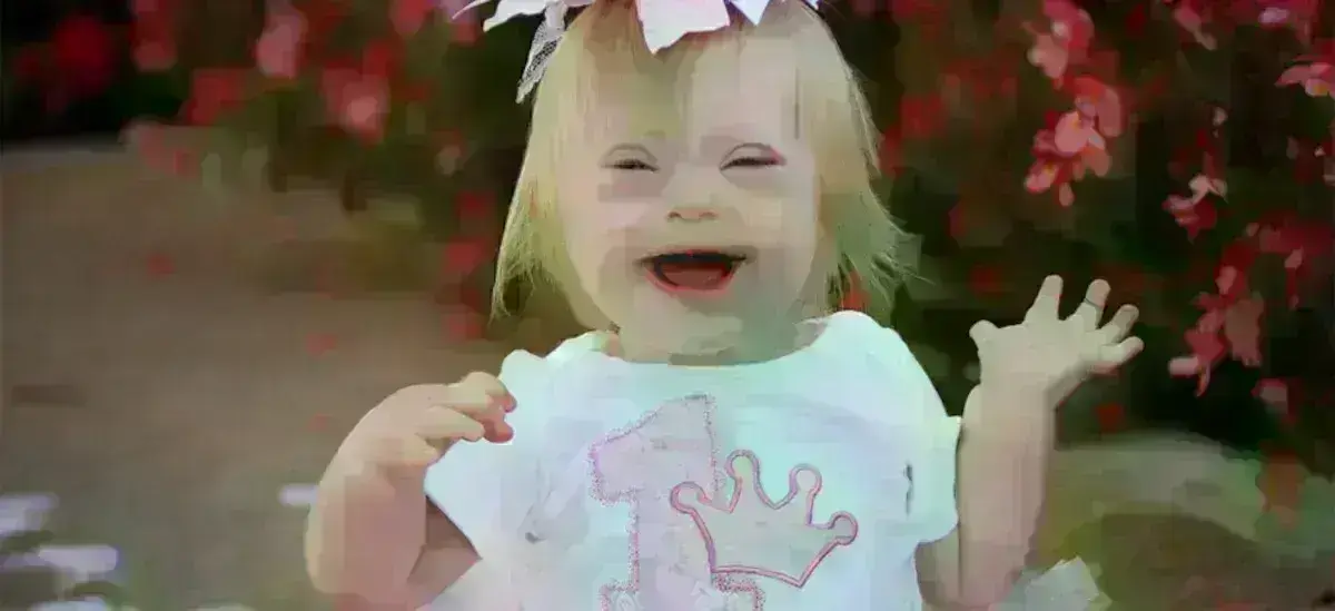 Σύνδρομο Down