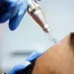 Σοκ: Τρεις γυναίκες διαγνώστηκαν με HIV μετά από «θεραπείες προσώπου»