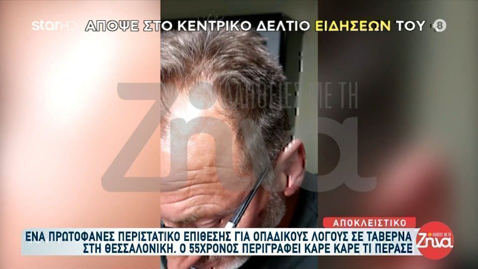 Οπαδικό επεισόδιο στη Θεσσαλονίκη: 20 άτομα εναντίον ενός για το Κύπελλο- Δε συνελήφθη κανείς