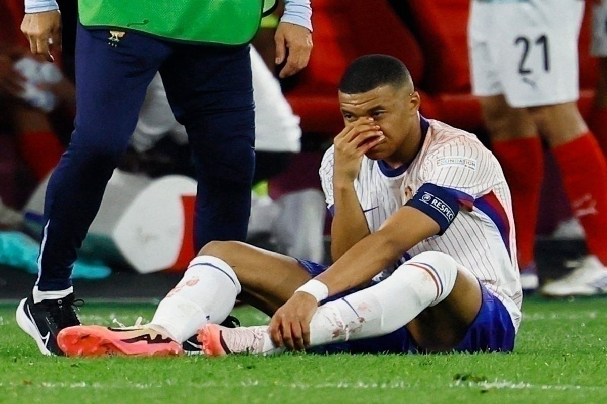 Γαλλία: Πλήγμα με Εμπαπέ – Δεν παίζει με την Ολλανδία, συνεχίζει με μάσκα στη διοργάνωση