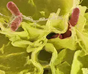 Τι είναι η σαλμονέλα