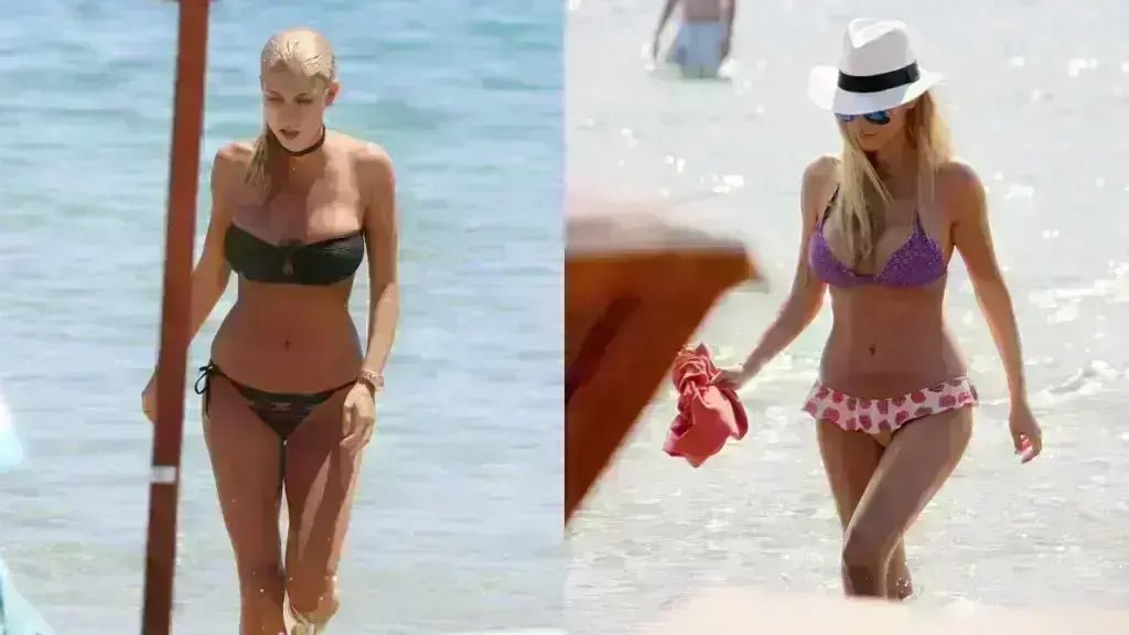 5+1 Διάσημες Ελληνίδες που έχουν κάνει πλαστική στήθους – Ποια αντί να βάλει, έβγαλε και στεναχώρησε τον άντρα της;