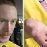 Ολυμπιακοί Αγώνες 2024: Πασίγνωστος ολυμπιονίκης ακρωτηρίασε το δάχτυλό του για να αγωνιστεί