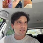 Σπύρος Χατζηαγγελάκης: Νομικά κινήθηκε μετά την επίθεση που δέχτηκε από σκύλο [βίντεο]