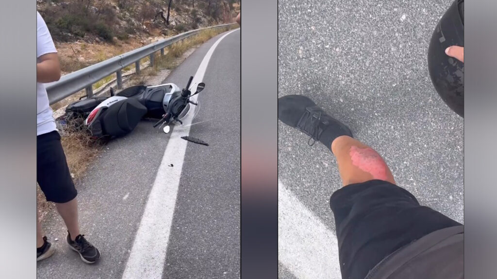 Ατύχημα με scooter για τον influencer Αλέξανδρο Κοψιάλη, έμεινε λίγο… δέρμα στην άσφαλτο