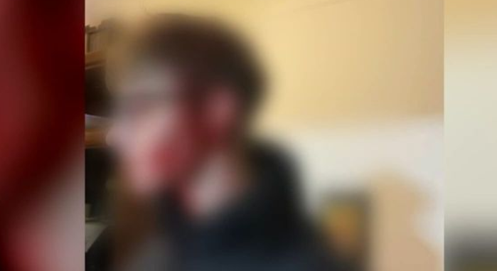Σοκάρει μάρτυρας για την επίθεση σε δύο ανήλικους στη Θεσσαλονίκη: «Ήταν μέσα στα αίματα, τους χτύπησαν με σίδερο» [βίντεο]