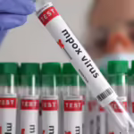 Ιός Mpox: Νέα πανδημία μπροστά μας; – Εξαπλώνεται με ανησυχητικό ρυθμό – Έφτασε στη Γερμανία η νέα παραλλαγή