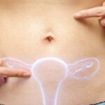 Ενδομητρίωση: Μπορεί να επηρεάσει τη γονιμότητα μιας γυναίκας;