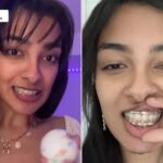 19χρονη tiktoker έφαγε καραμέλα και έσπασε το σαγόνι της – Είχε μέγεθος μπάλας του… τένις (βίντεο)