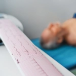 Αρρύθμιστο σάκχαρο: Φέρνει επικίνδυνες αρρυθμίες στην καρδιά και κολπική μαρμαρυγή