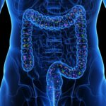 Καρκίνος του παχέος εντέρου: Το πρωινό που μπορεί να μειώσει τον κίνδυνο εμφάνισής του