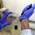 Καρκίνος του προστάτη: Αυξάνεται κατά 45% στους άνδρες που υιοθετούν μία ανησυχητική συνήθεια