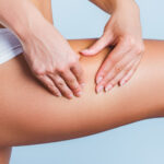 Η μάχη της κυτταρίτιδας ξεκινά από τώρα – Με αυτή τη δίαιτα θα σωθείτε