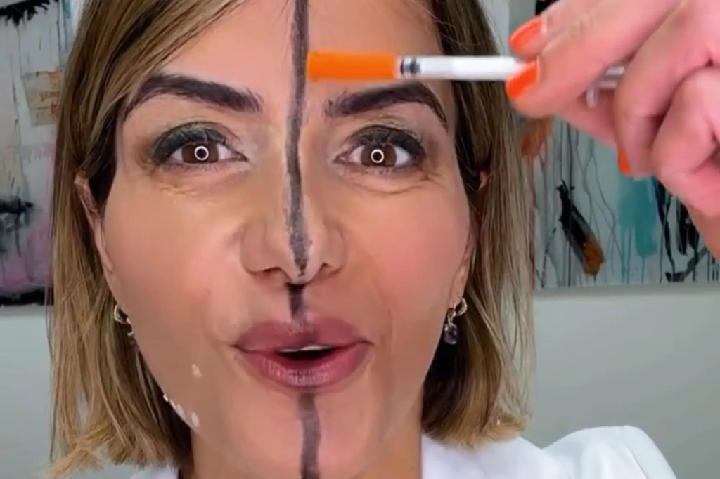 Γιατρός γίνεται πειραματόζωο: Κάνει botox στο μισό της πρόσωπο -Σοκάρει το αποτέλεσμα (βίντεο)