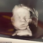 Το Χέρι του Θεού: Μυστηριώδης εμφάνιση σε υπερηχογράφημα – Πώς η προσευχή της μητέρας κρύβει την απάντηση