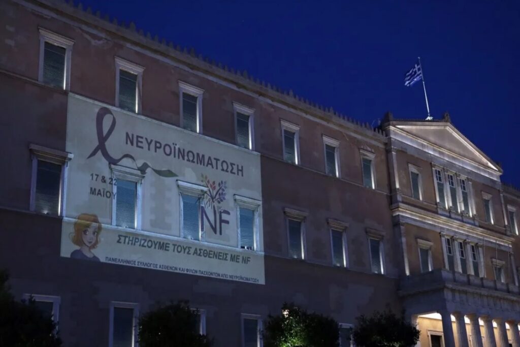 Η Βουλή φωταγωγήθηκε για την Παγκόσμια Ημέρα για την Νευροϊνωμάτωση