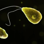 Τέξας: Νεκρή 71χρονη – Αμοιβάδα της έφαγε τον εγκέφαλο – Πώς συνέβη η τραγωδία