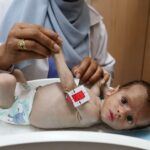 Γάζα: «Αναγκαία» η διασφάλιση συνεχούς ροής ιατρικής βοήθειας, λέει ο επικεφαλής του Παγκόσμιου Οργανισμού Υγείας