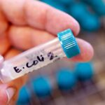 Βέλγιο: Τέσσερις ηλικιωμένοι νεκροί από το βακτήριο E.coli σε οίκους ευγηρίας