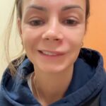 Προειδοποίηση: «Έσπασα ένα σπυράκι στο “τρίγωνο του θανάτου” και κατέληξα στα επείγοντα με 4 φάρμακα»