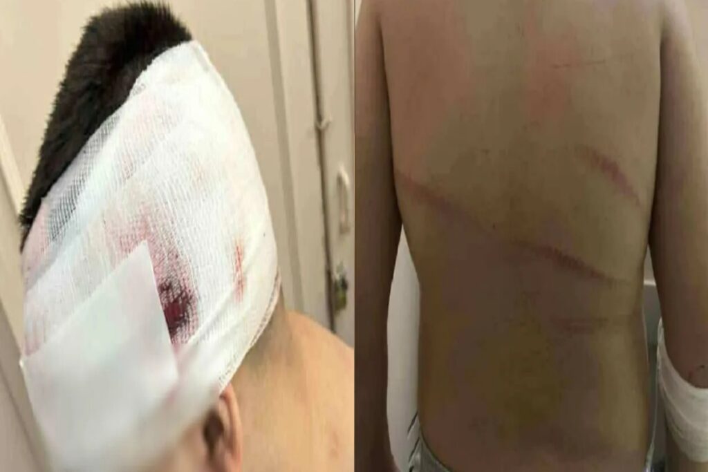Θεσσαλονίκη: Ελεύθερος με επιβολή αναμορφωτικών μέτρων ο 18χρονος για τον άγριο ξυλοδαρμό 13χρονου στις Συκιές