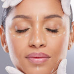 Βοτουλινική τοξίνη (μπότοξ): Συμβουλές μετά τη θεραπεία για βέλτιστο αποτέλεσμα