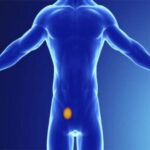 Λαπαροσκοπική Αποκατάσταση Βουβωνοκήλης με την Τεχνική TEP