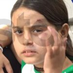 Σεπόλια: Γυναίκα πήγε να απαγάγει 9χρονο κοριτσάκι και το παρέσυρε με το αυτοκίνητο – Η σοκαριστική αφήγηση της μικρής