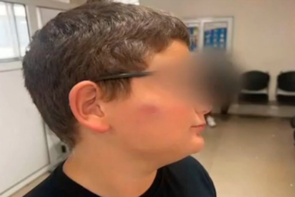 Θεσσαλονίκη: 11χρονος ξυλοκοπήθηκε σε σχολείο – «Η διευθύντρια μου είπε να του μάθω να μην δίν