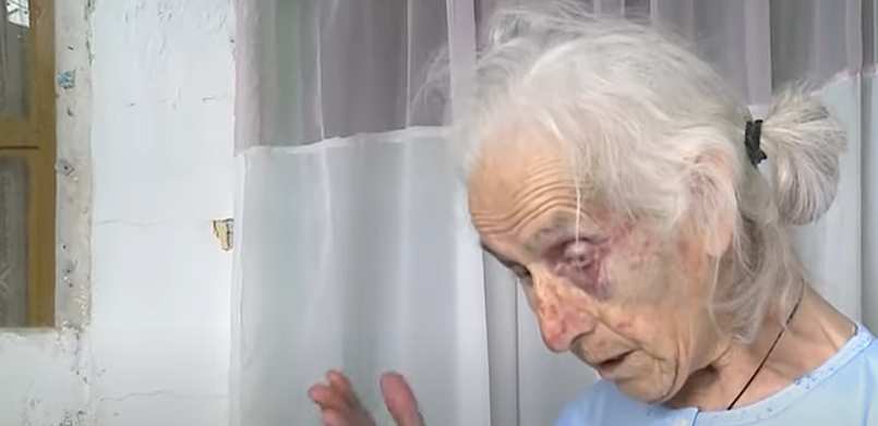 Άγρια επίθεση σε ηλικιωμένη στην Αιτωλοακαρνανία – Ληστές την ξυλοκόπησαν βάναυσα για… 100 ευρώ [βίντεο]