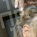 Σοκ στη Συγγρού: Πλαστικός χειρουργός επιτέθηκε άγρια σε 43χρονη μέσα στο αυτοκίνητο – Τη χτύπησε στο τιμόνι και της ξερίζωσε τα μαλλιά