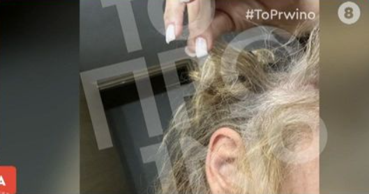 Σοκ στη Συγγρού: Πλαστικός χειρουργός επιτέθηκε άγρια σε 43χρονη μέσα στο αυτοκίνητο – Τη χτύπησε στο τιμόνι και της ξερίζωσε τα μαλλιά