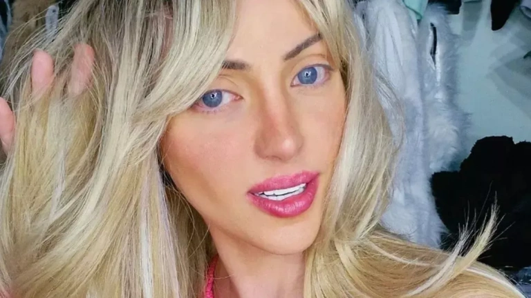 Νεκρή στα 31 η ανθρώπινη «Barbie»: Μυστήριο γύρω από τον θάνατό της στη Βραζιλία – Είχε υποβληθεί σε 27 πλαστικές επεμβάσεις