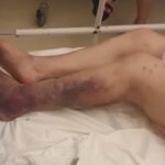 Γηροκομείο-κολαστήριο: Άγρια κακοποίηση 89χρονης – Τι καταγγέλλει ο εγγονός για τον θάνατό της (βίντεο)