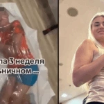 Σφοδρές αντιδράσεις στη Ρωσία για μητέρα που έκλεισε τον γιο της σε σακούλα και αφαίρεσε τον αέρα [βίντεο]