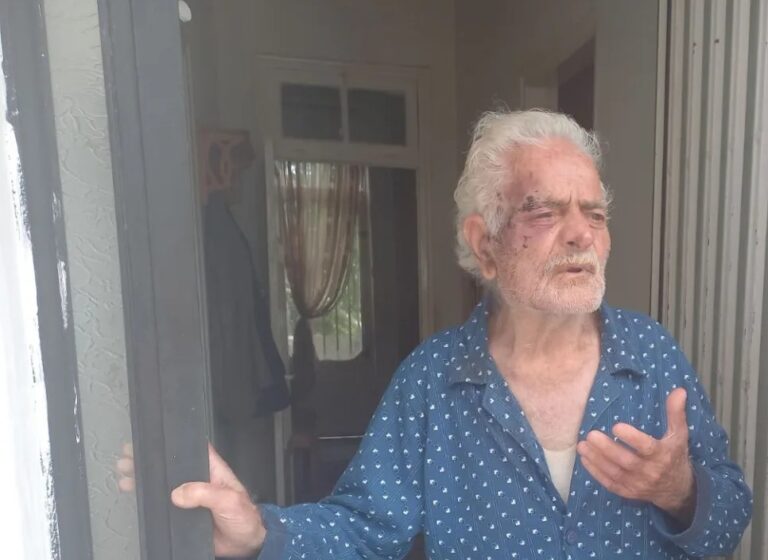 Άγρια ληστεία στην Πάτρα: Εφιαλτικές στιγμές για ένα ηλικιωμένο ζευγάρι – Τους ξυλοκόπησαν ανελέητα