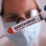Θάνατος από χανταϊό στο Κολοράντο – Τι λένε οι αρχές για το κρουαζιερόπλοιο MV Hondius και τα νέα μέτρα για τον Έμπολα στις ΗΠΑ
