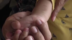 Η viral άσκηση με το μικρό δάχτυλο υπόσχεται να προστατεύσει τον εγκέφαλο από την άνοια – Τι λένε όμως οι ειδικοί;