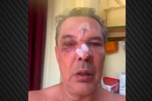 Χαϊδάρι: Άγριος ξυλοδαρμός μέσα σε ιατρείο επειδή του έκανε παρατήρηση να μιλά πιο σιγά στο κινητό