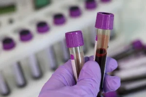 Γιατροί και νοσηλευτές ενώνουν τις δυνάμεις τους για τη Θαλασσαιμία